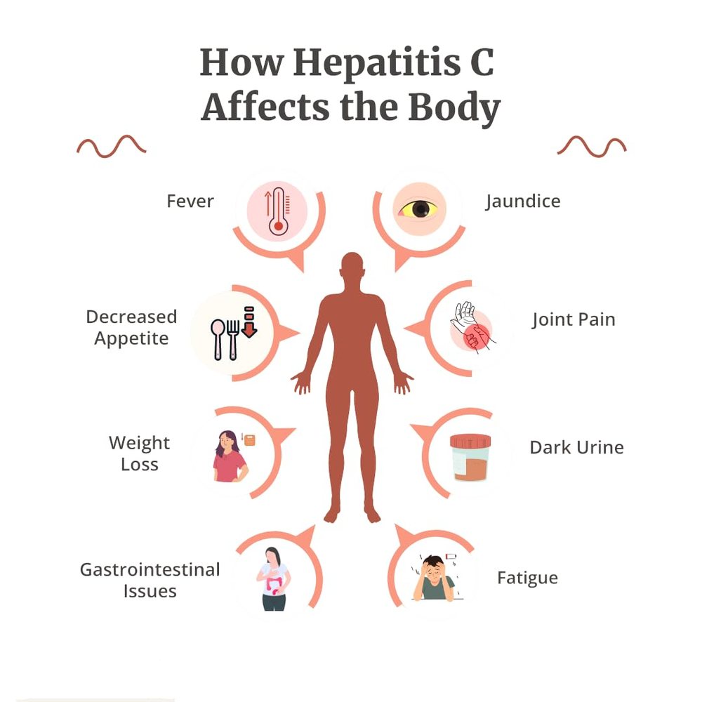HCV (Hepatitis C) Antibody Test Kit — Pack of 5 — image 4