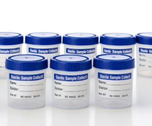 Sterilized Urine Collection Containers