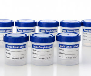 Sterilized Urine Collection Containers